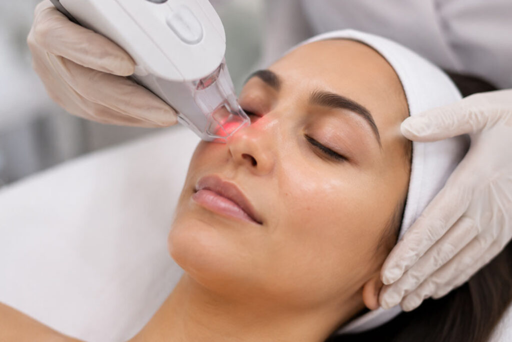 Wie lange hält eine Unterlidstraffung mit Laser?